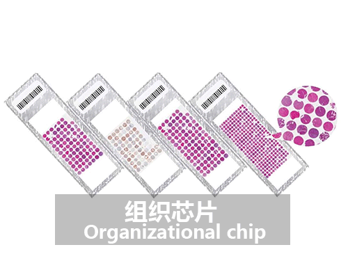 组织芯片